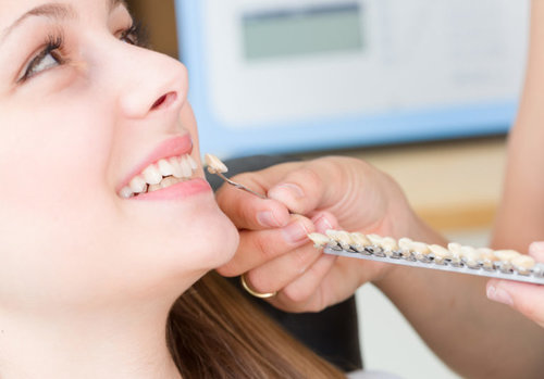 Pikesville Dental Associates - Veneers