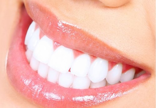 Pikesville Dental Associates - Teeth Whitening
