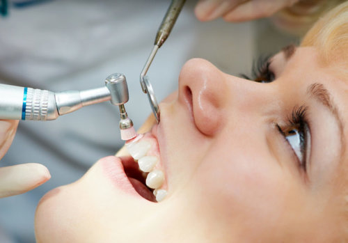 Pikesville Dental Associates - Cleaning 